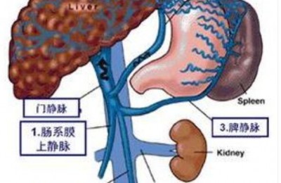 倪海厦：胆结石的常用基础方