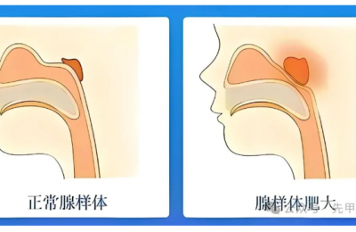 倪海厦人纪实践 调理40天，小侄女的腺样体肥大好了80%…